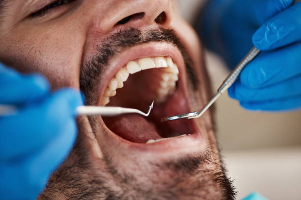 Best Emergency Root Canal Treatment in East End, AR