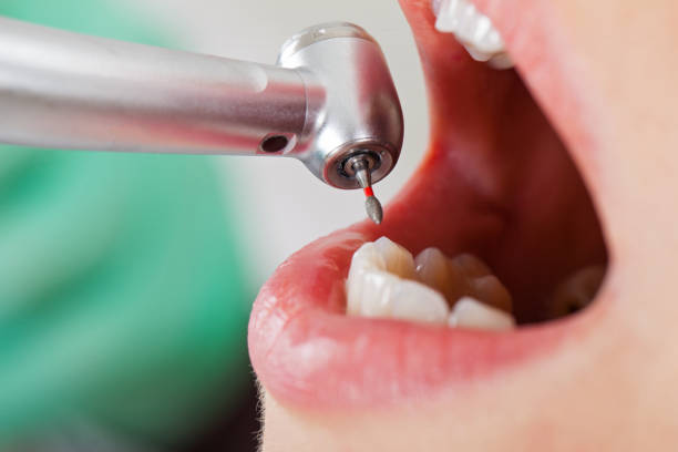 Best Emergency Tooth Extraction in East End, AR